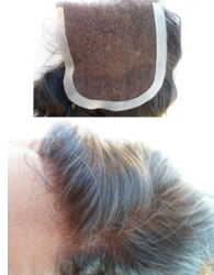 Lace Closures